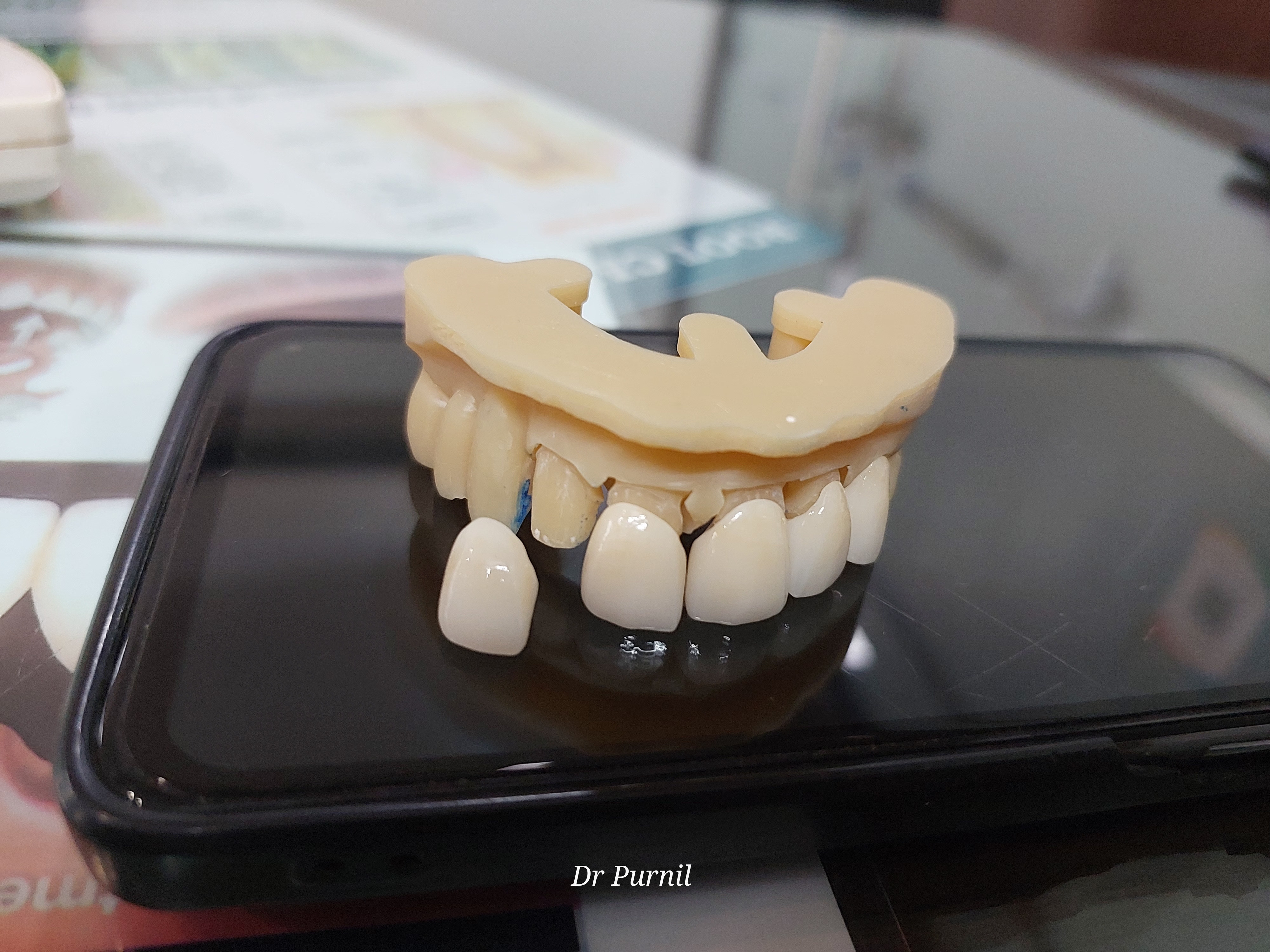 Smile Transformation 2