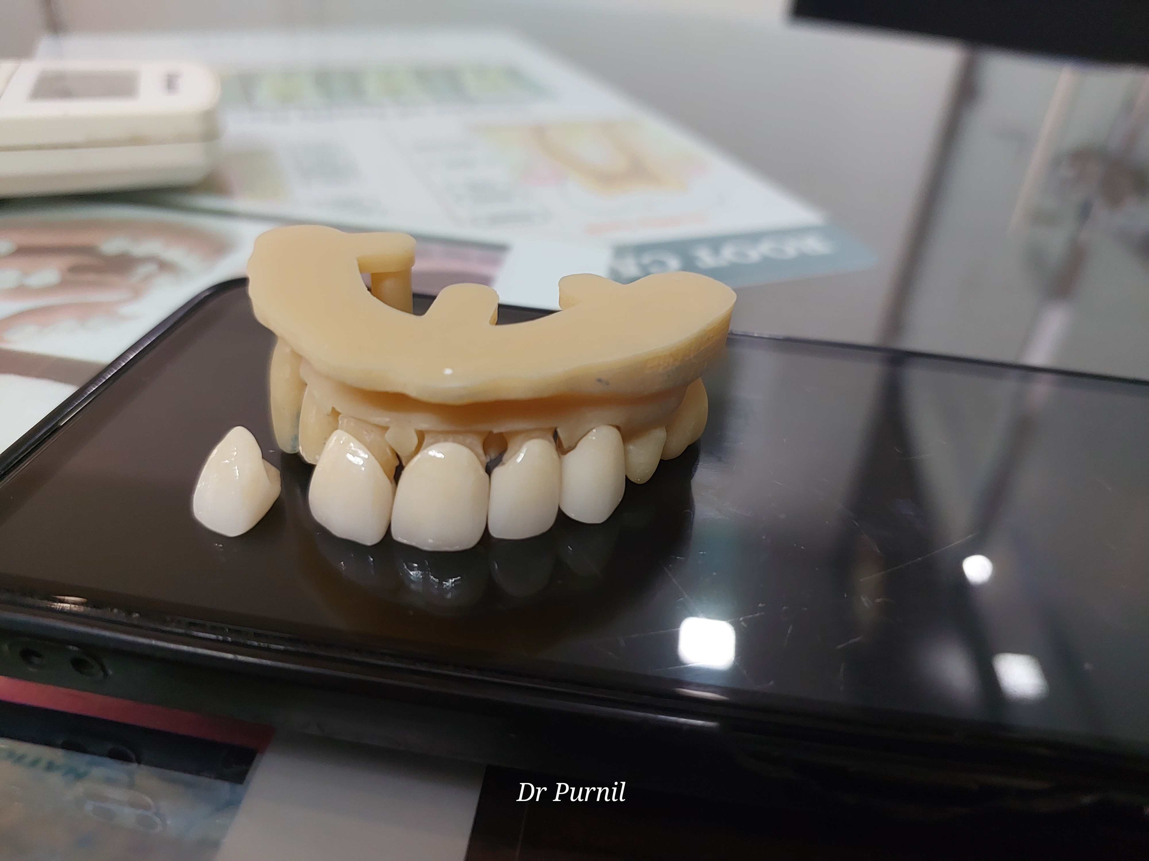 Smile Transformation 3